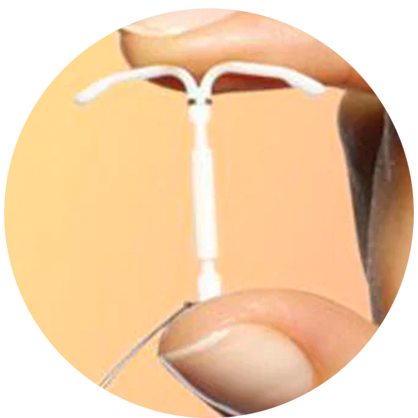 Photo of Skyla IUD